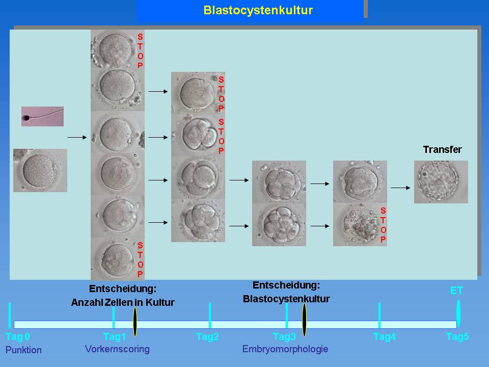 Blastozyste schaffen wie eizellen viele es zur Kinderwunschtage in