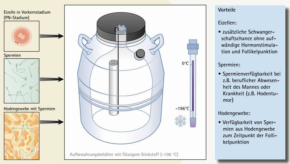 Kryokonservierung.jpg