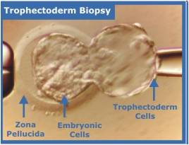 trophectoderm.jpg